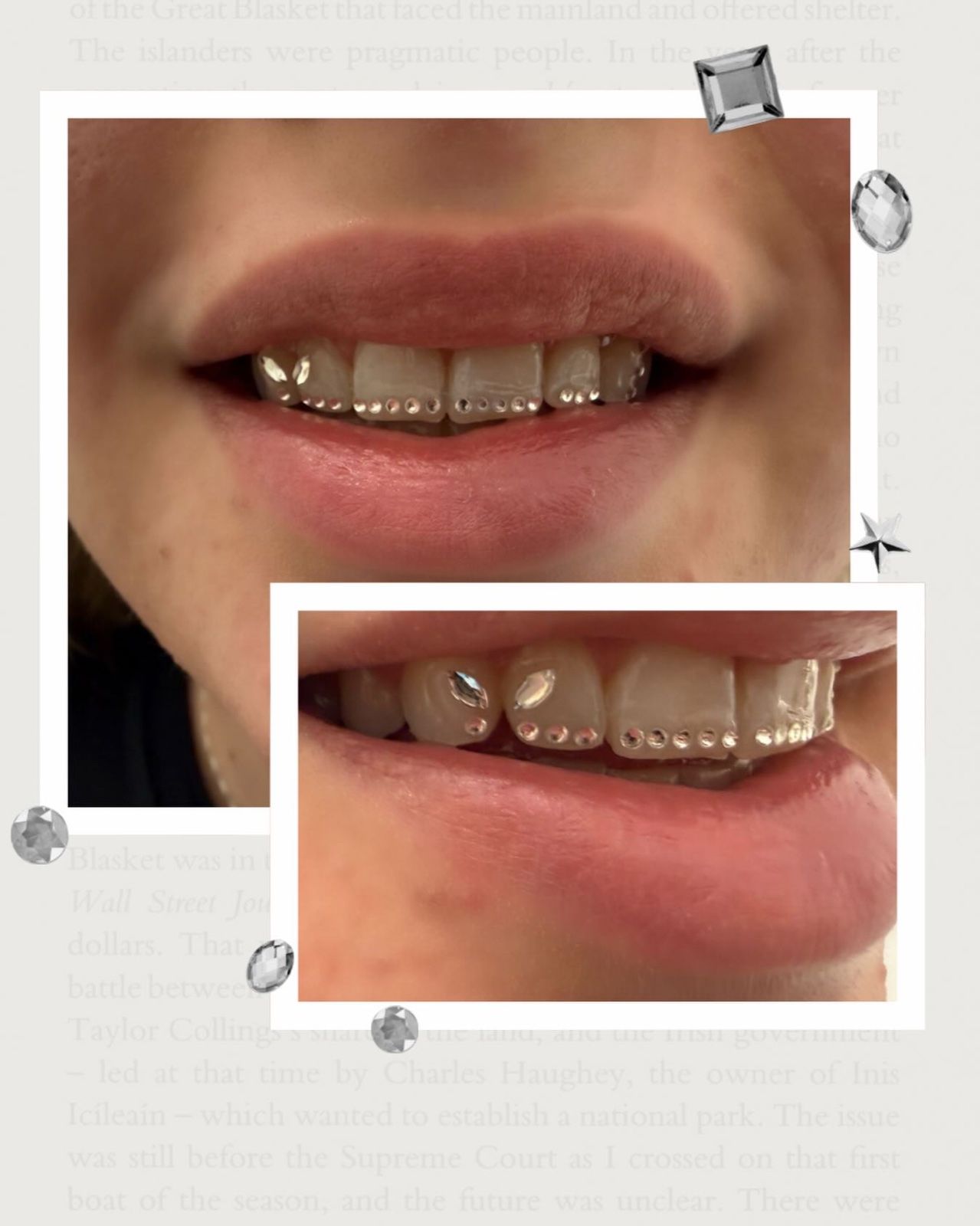 Lächeln mit kleinen Grillz und Tooth Gems, Collage aus zwei Fotos