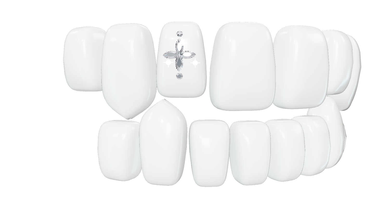 Micro Starlight als 3D-Ansicht auf einem Gebiss